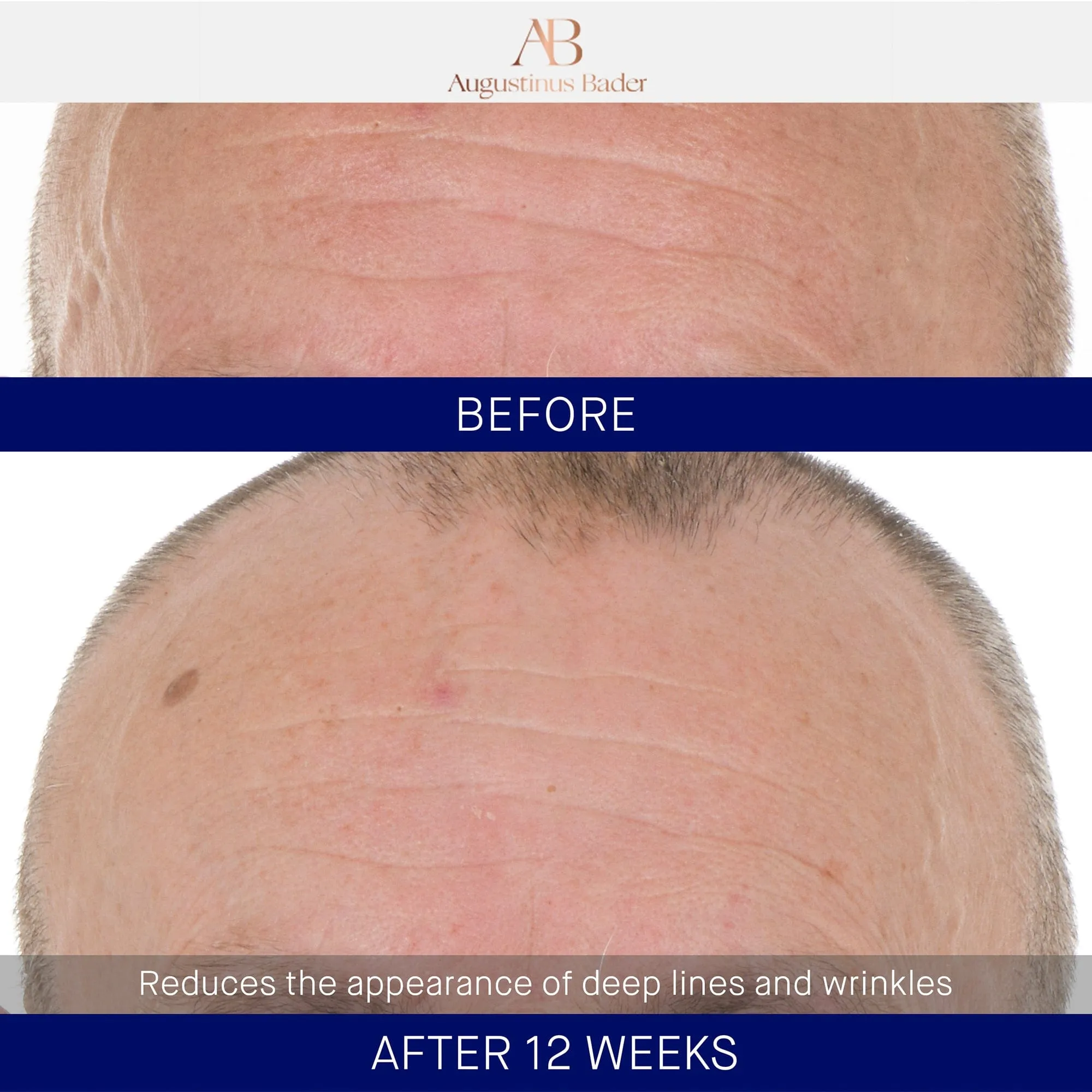 The Retinol Serum Augustinus Bader Sérum de retinol