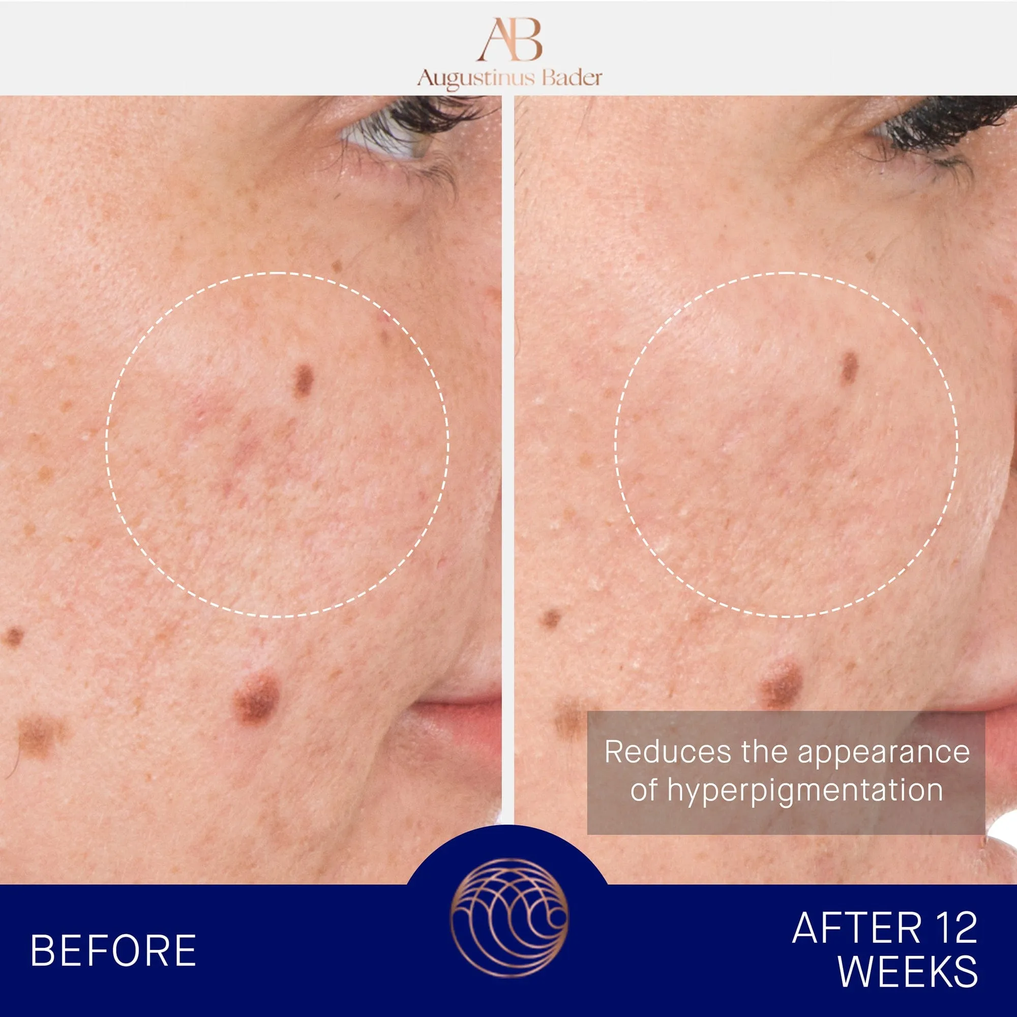 The Retinol Serum Augustinus Bader Sérum de retinol