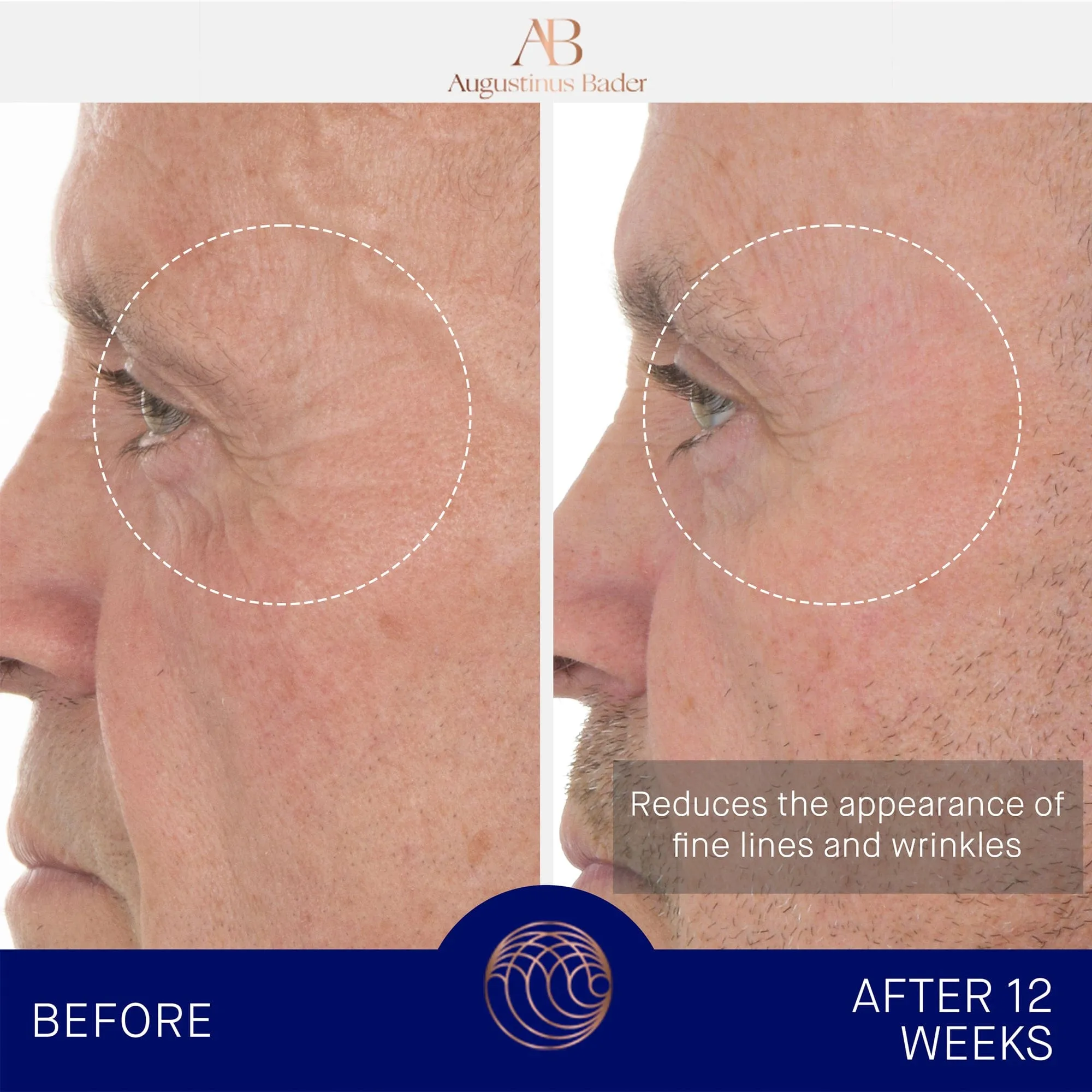 The Retinol Serum Augustinus Bader Sérum de retinol